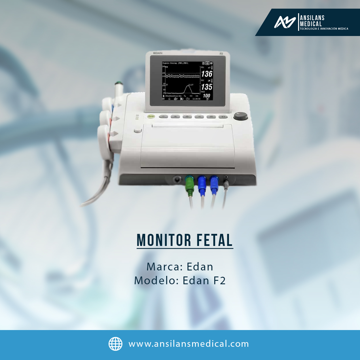 Monitor Edan